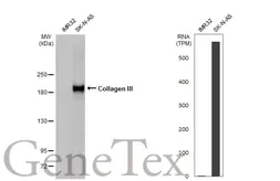 Anti-Collagen III antibody [HL1908] used in Western Blot (WB). GTX637657