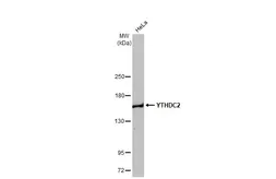 Anti-YTHDC2 antibody [HL1916] used in Western Blot (WB). GTX637665