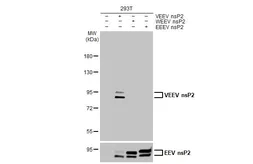 Anti-Venezuelan Equine Encephalitis Virus nsP2 antibody [HL1919] used in Western Blot (WB). GTX637668
