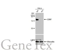 Anti-CD97 antibody [HL1925] used in Western Blot (WB). GTX637674