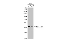 Anti-beta Actin antibody [HL1927] used in Western Blot (WB). GTX637676