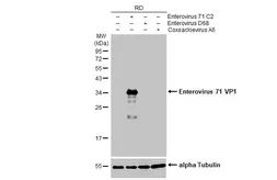 Anti-Enterovirus 71 VP1 antibody [HL1928] used in Western Blot (WB). GTX637687