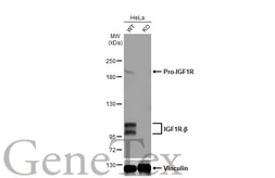 Anti-IGF1R beta antibody [HL1958] used in Western Blot (WB). GTX637795