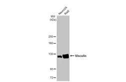 Anti-Vinculin antibody [HL1964] used in Western Blot (WB). GTX637857