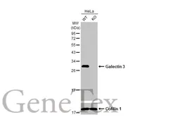Anti-Galectin 3 antibody [HL2020] used in Western Blot (WB). GTX637921