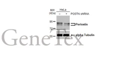 Anti-Periostin antibody [HL2112] used in Western Blot (WB). GTX638084