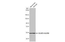 Anti-GLUD1+ GLUD2 antibody [HL2124] used in Western Blot (WB). GTX638096