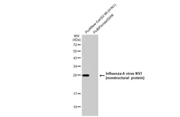 Anti-Influenza A virus NS1 (nonstructural protein) antibody [HL2130] used in Western Blot (WB). GTX638102