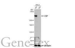 Anti-CBP antibody [HL2197] used in Western Blot (WB). GTX638201