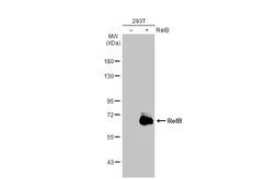Anti-RelB antibody [HL2222] used in Western Blot (WB). GTX638267