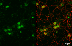 Anti-Brachyury antibody [HL2285] used in Immunocytochemistry/ Immunofluorescence (ICC/IF). GTX638338