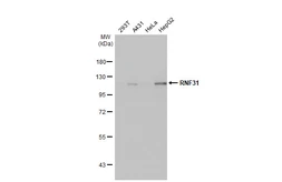 Anti-RNF31 antibody [HL2295] used in Western Blot (WB). GTX638350