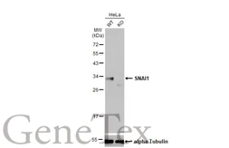 Anti-SNAI1 antibody [HL2303] used in Western Blot (WB). GTX638370