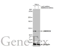 Anti-ANKRD32 antibody [HL2311] used in Western Blot (WB). GTX638474