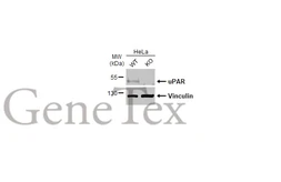 Anti-uPAR antibody [HL2398] used in Western Blot (WB). GTX638615