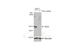 Anti-TET3 antibody [HL2463] used in Western Blot (WB). GTX638781