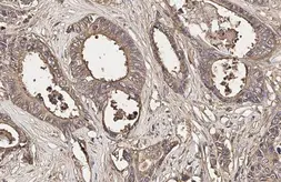 Anti-CD66e antibody [HL2467] used in IHC (Paraffin sections) (IHC-P). GTX638816