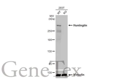 Anti-Huntingtin antibody [HL2483] used in Western Blot (WB). GTX638832