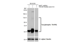 Anti-Tau (phospho Thr181) antibody [HL2497] used in Western Blot (WB). GTX638855