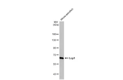 Anti-Lcp1 antibody [HL2501] used in Western Blot (WB). GTX638859