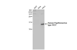 Anti-Human Papillomavirus type 18 E7 antibody [HL2522] used in Western Blot (WB). GTX638883