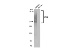 Anti-KCC2 antibody [HL2535] used in Western Blot (WB). GTX638904