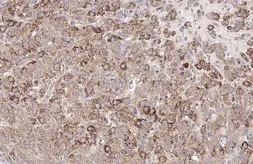 Anti-ROBO1 antibody [HL2559] used in IHC (Paraffin sections) (IHC-P). GTX638936