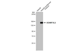 Anti-ADAMTSL2 antibody [HL2616] used in Western Blot (WB). GTX639070
