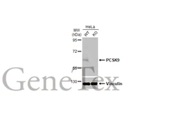 Anti-PCSK9 antibody [HL2666] used in Western Blot (WB). GTX639330