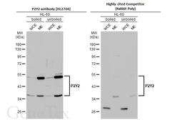 Anti-P2Y2 antibody [HL2704] used in Western Blot (WB). GTX639458