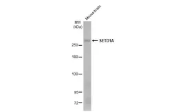 Anti-SETD1A antibody [HL2705] used in Western Blot (WB). GTX639459