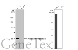 Anti-Tyrosine Hydroxylase antibody [HL2721] used in Western Blot (WB). GTX639548