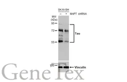 Anti-Tau antibody [HL2736] used in Western Blot (WB). GTX639564