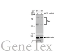 Anti-Tau antibody [HL2802] used in Western Blot (WB). GTX639694