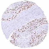 Anti-KDM6A antibody [HMV311] HistoMAX&trade; used in IHC (Paraffin sections) (IHC-P). GTX639935
