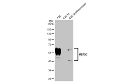 Anti-MEF2C antibody [HL2811] used in Western Blot (WB). GTX639952