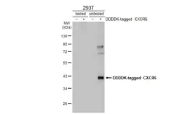 Anti-CXCR6 antibody [HL2849] used in Western Blot (WB). GTX640120