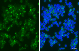 Anti-CCR10 antibody [HL2853] used in Immunocytochemistry/ Immunofluorescence (ICC/IF). GTX640124