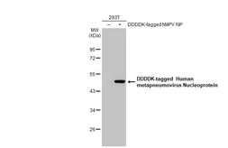 Anti-Human metapneumovirus Nucleoprotein antibody [HL2919] used in Western Blot (WB). GTX640262