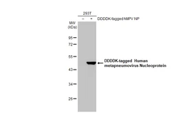 Anti-Human metapneumovirus Nucleoprotein antibody [HL2921] used in Western Blot (WB). GTX640264