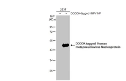Anti-Human metapneumovirus Nucleoprotein antibody [HL2924] used in Western Blot (WB). GTX640267