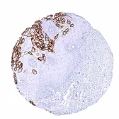 Anti-CA19-9 antibody [HMV333] HistoMAX&trade; used in IHC (Paraffin sections) (IHC-P). GTX640565