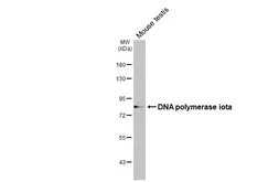 Anti-DNA polymerase iota antibody [HL3115] used in Western Blot (WB). GTX640591