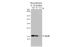 Anti-IL10 antibody [HL3118] used in Western Blot (WB). GTX640594