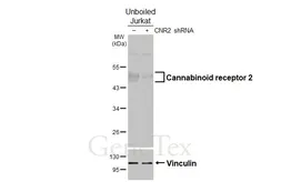 Anti-Cannabinoid receptor 2 antibody [HL3120] used in Western Blot (WB). GTX640596