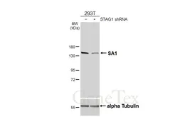 Anti-SA1 antibody [HL3139] used in Western Blot (WB). GTX640631