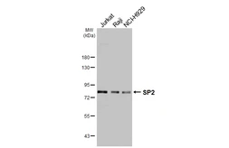 Anti-SP2 antibody [HL3155] used in Western Blot (WB). GTX640665