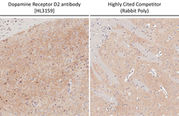 Anti-Dopamine Receptor D2 antibody [HL3159] used in IHC (Paraffin sections) (IHC-P). GTX640669