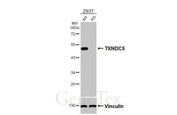 Anti-TXNDC5 antibody [HL3200] used in Western Blot (WB). GTX640840
