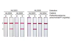 Anti-Mycoplasma pneumoniae P1 protein antibody [HL3205] used in Lateral Flow (Lateral Flow). GTX640845